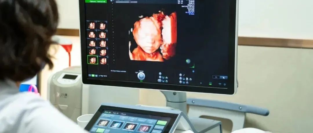 为什么我的四维没别人清楚？是不是医生没认真“拍”？
